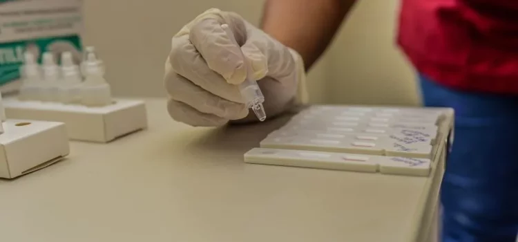 Rede de laboratórios da rede privada de Salvador registra aumento da procura por testes rápidos da Covid-19
