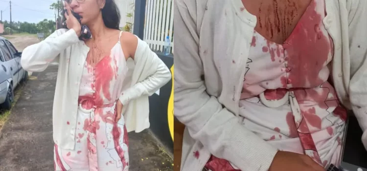 Caso de jovem que teve rosto cortado em ônibus na Bahia completa um mês; estudante fala sobre trauma
