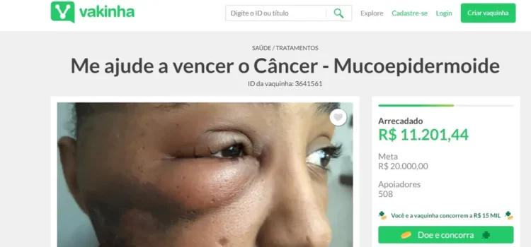 Baiana busca ajuda para tratamento contra câncer no rosto; conheça a história
