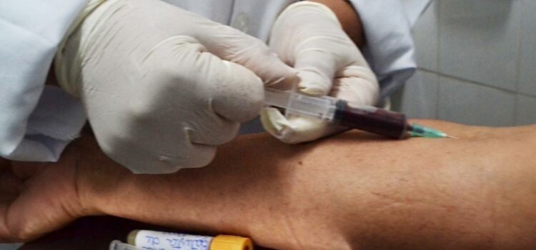 Mais de 400 exames de dengue realizados pelo Ambulatório de Infectologia e CSE