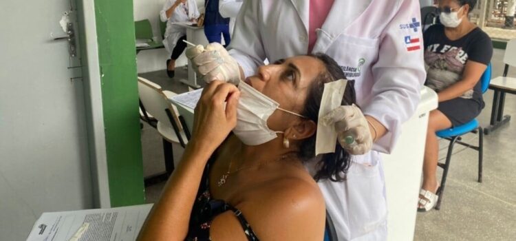 De forma temporária, apenas RT-PCR será realizado para diagnóstico da covid