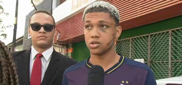 Jovem leva 37 pontos no rosto após ser agredido com garrafa de vidro ao separar briga em saída de festa na Bahia