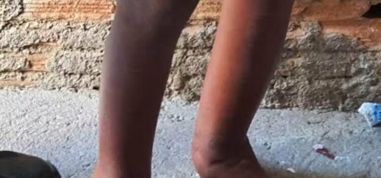 Menino resgatado acorrentado em barril é adotado, após 2 anos