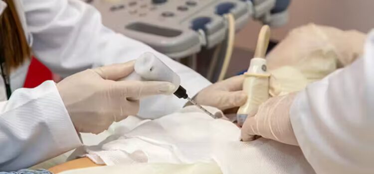 Nova técnica brasileira contra câncer de mama congela tumores e tem 100% de sucesso; Unifesp