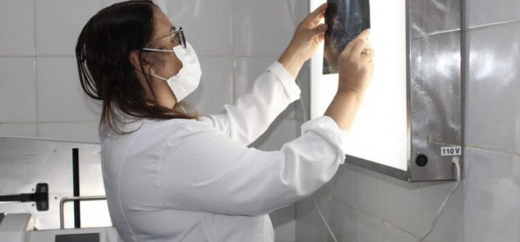 Fundação Hospitalar estima superar, em 2026, número de mamografias realizadas no ano passado