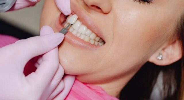 Mulheres vítimas de violência terão reconstrução dentária gratuita pelo SUS