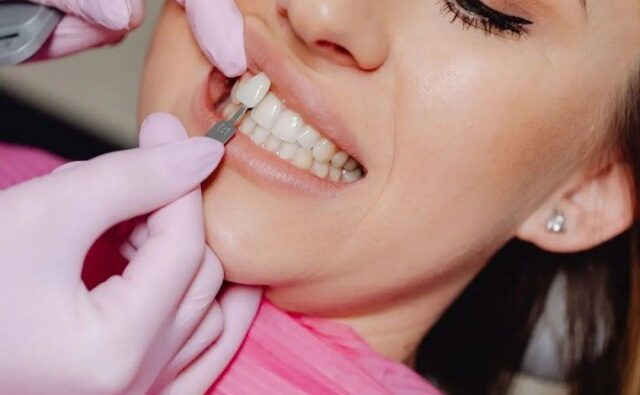 Mulheres vítimas de violência terão reconstrução dentária gratuita pelo SUS