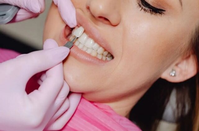 Mulheres vítimas de violência terão reconstrução dentária gratuita pelo SUS