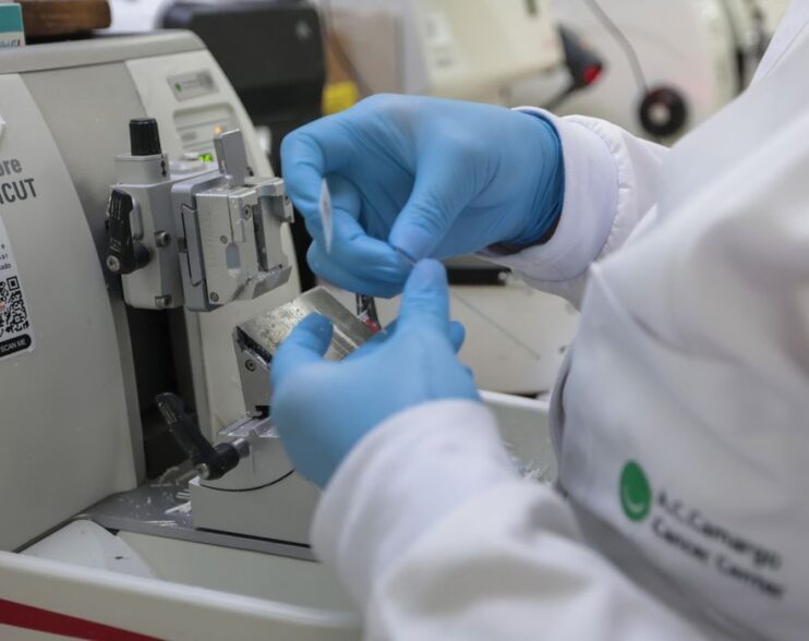 SUS passa a oferecer nova terapia para adultos com leucemia mieloide aguda