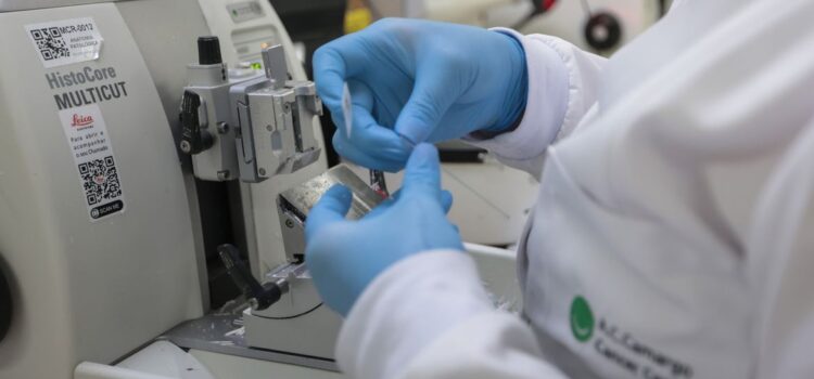 SUS passa a oferecer nova terapia para adultos com leucemia mieloide aguda