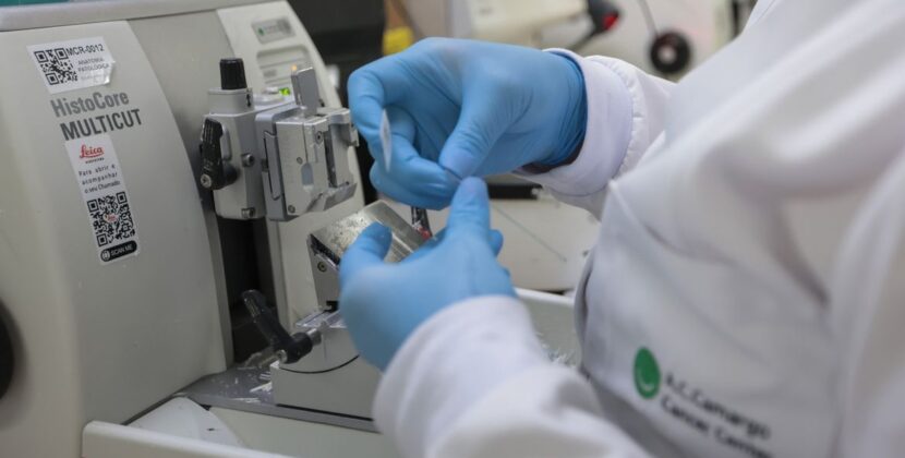 SUS passa a oferecer nova terapia para adultos com leucemia mieloide aguda