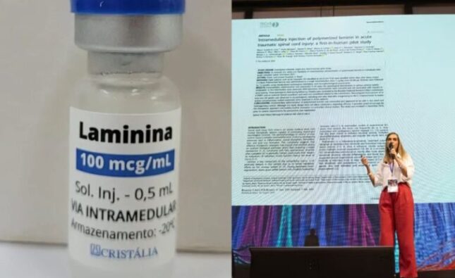 Estudo da Dra. Tatiana da polilaminina sai em revista científica internacional: 75% tiveram melhora