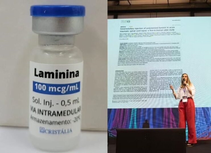 Estudo da Dra. Tatiana da polilaminina sai em revista científica internacional: 75% tiveram melhora