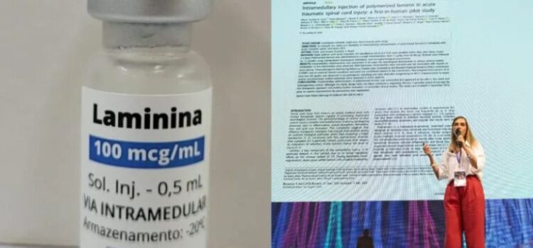 Estudo da Dra. Tatiana da polilaminina sai em revista científica internacional: 75% tiveram melhora