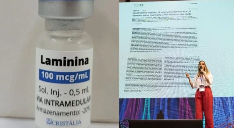 Estudo da Dra. Tatiana da polilaminina sai em revista científica internacional: 75% tiveram melhora